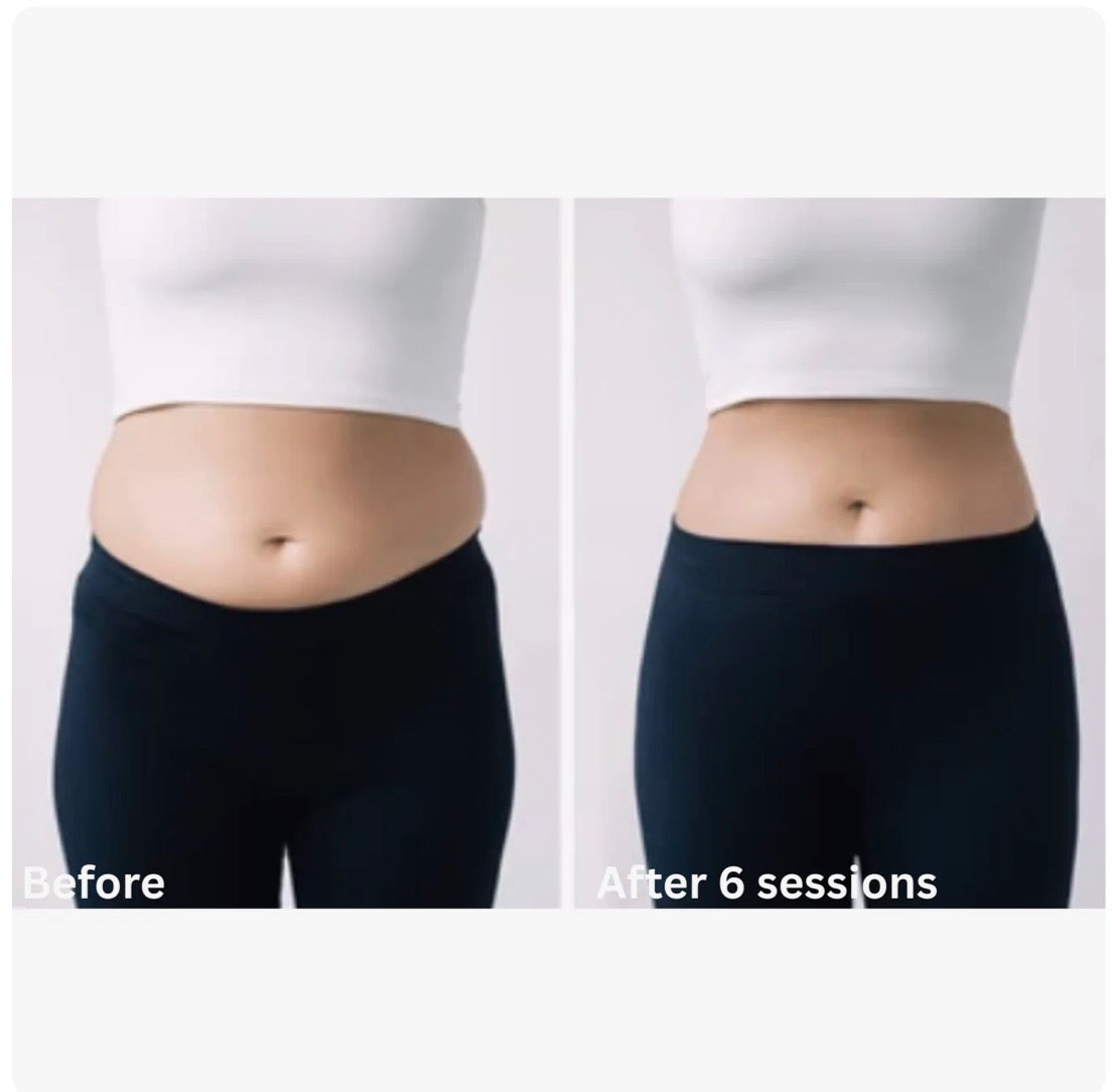 CELLTUNE ia-100RF: Professional Multipolar RF & Vacuum Body Contouring Therapy Device