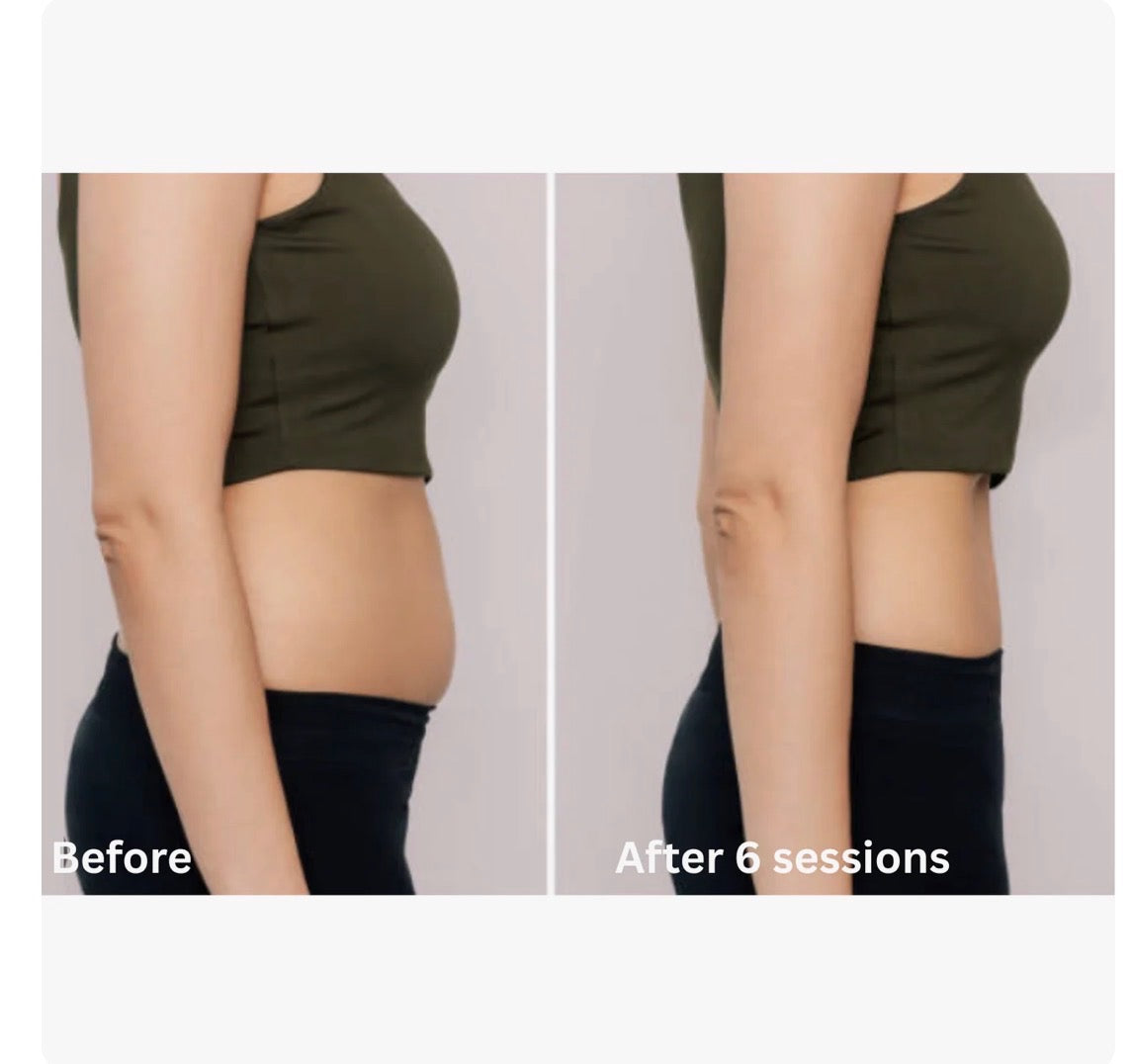 CELLTUNE ia-100RF: Professional Multipolar RF & Vacuum Body Contouring Therapy Device